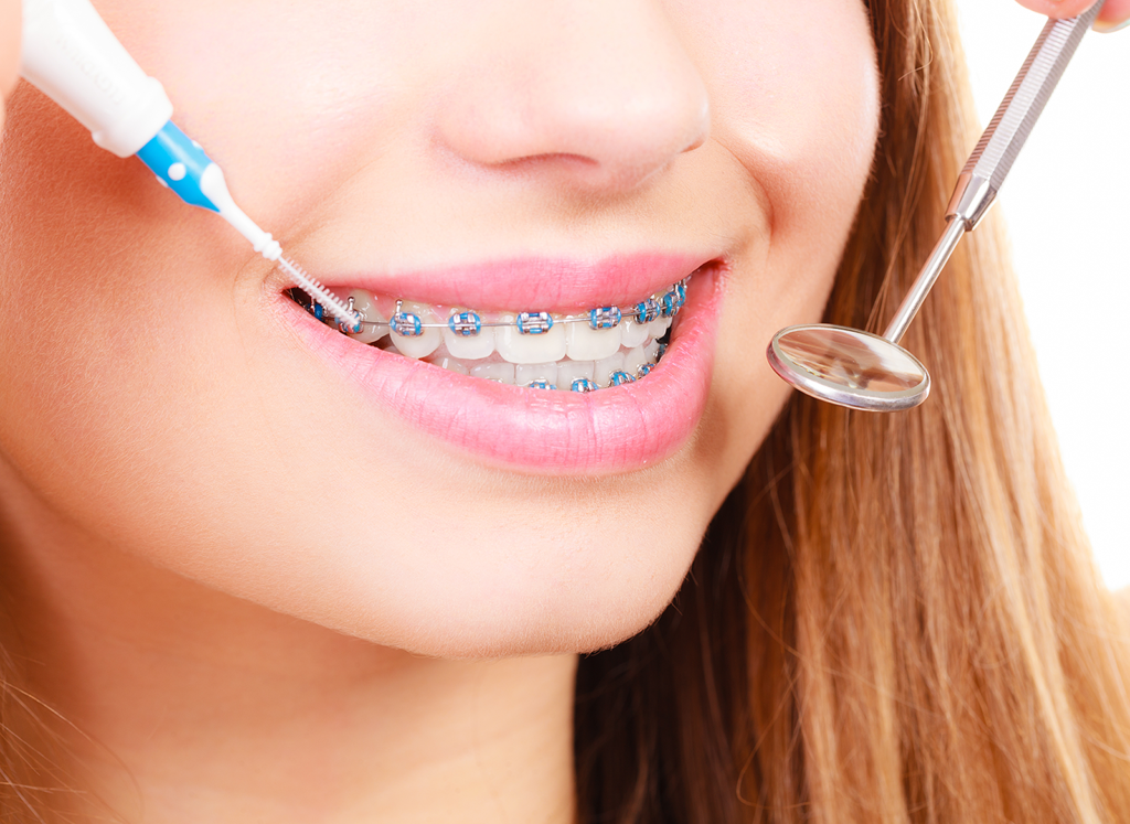 Cosmetic Dentist McAllen | Mission | Sedation | Braces | RGV